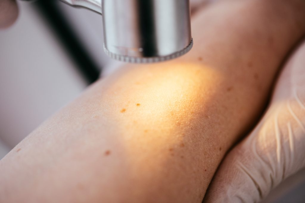 Skin Check At Point Cook